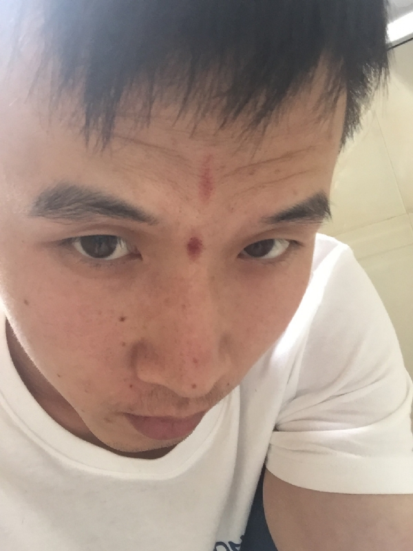 爱晴的第一张照片--宁德残疾人相亲网